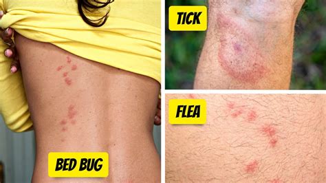 BIT ME [ Complete ] .